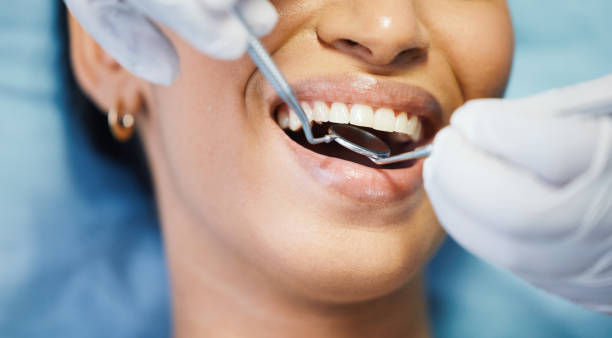 Best Emergency Tooth Extraction in Brookhaven, MS