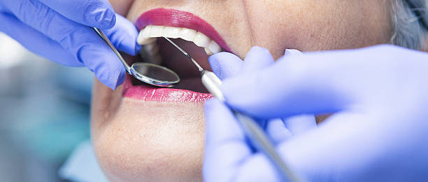 Best Emergency Broken Tooth Repair in Brookhaven, MS